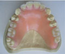 baldenture.png