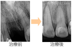 外傷